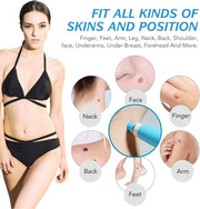 ALIVER 2in1 Blue Skin Tag Removal Kit