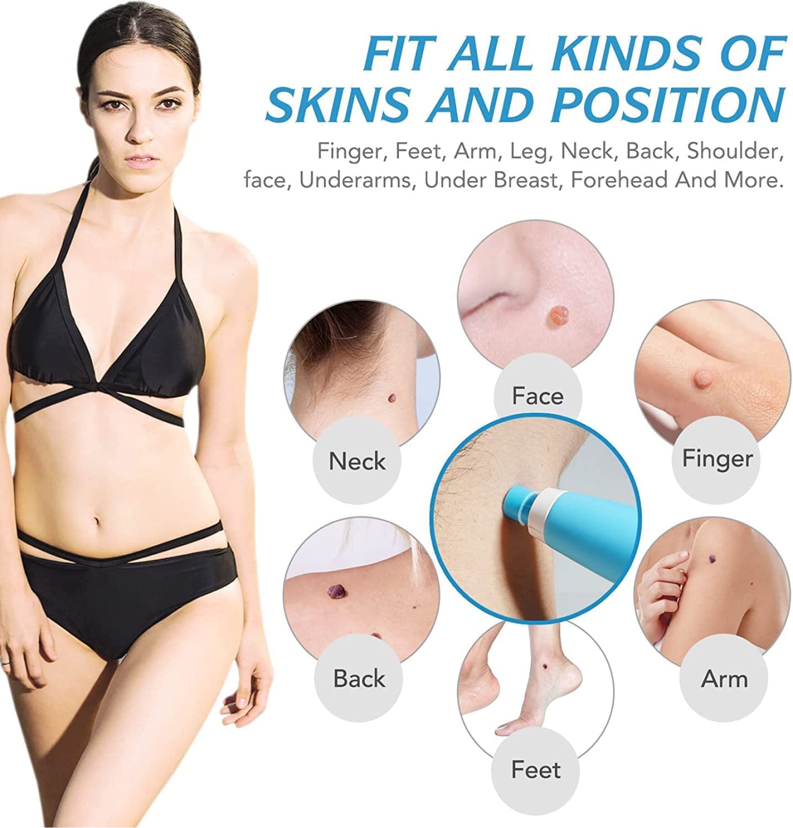 ALIVER 2in1 Blue Skin Tag Removal Kit