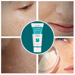 Aliver Dark Spot Remover Corrector Brighter for Face Body Skin Cream