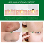 ELBBUB Blackhead Face Mask Essence, 17ml