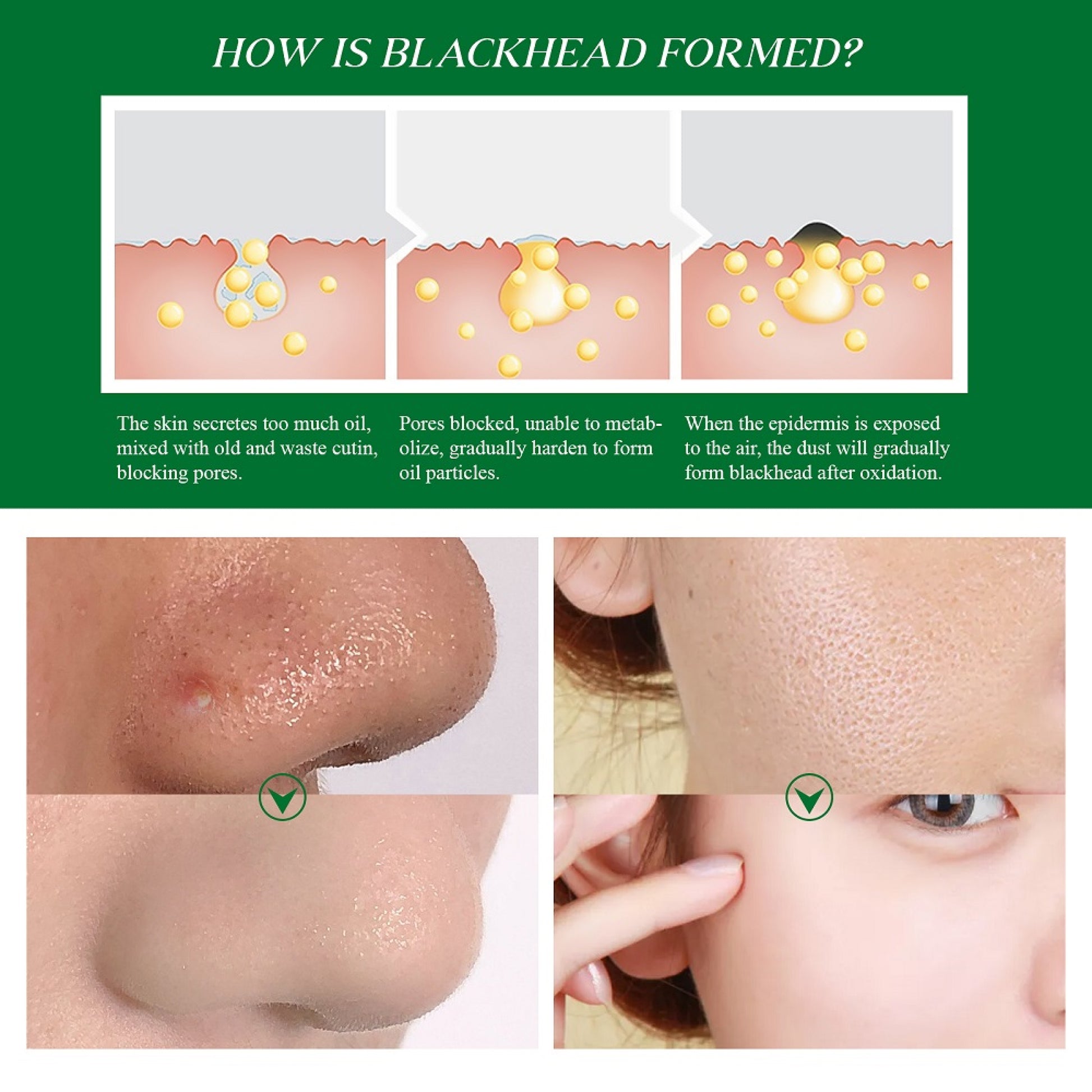 ELBBUB Blackhead Face Mask Essence, 17ml