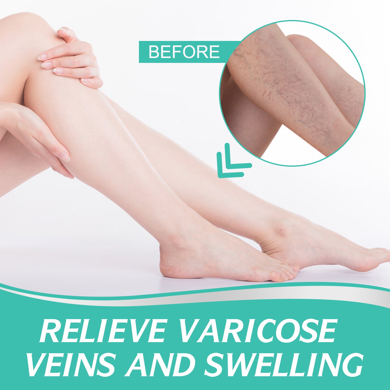 Varicose Veins Patch Treatment for Legs Relief Pain Vasculitis, Spider Vein Strengthen Capillary Health Blood Circulation Vein Care Fading  (8 count)