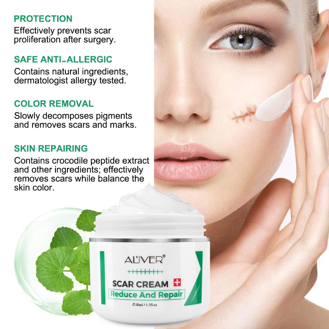 Aliver Treatment Scar Remove Cream for Body Face Skin