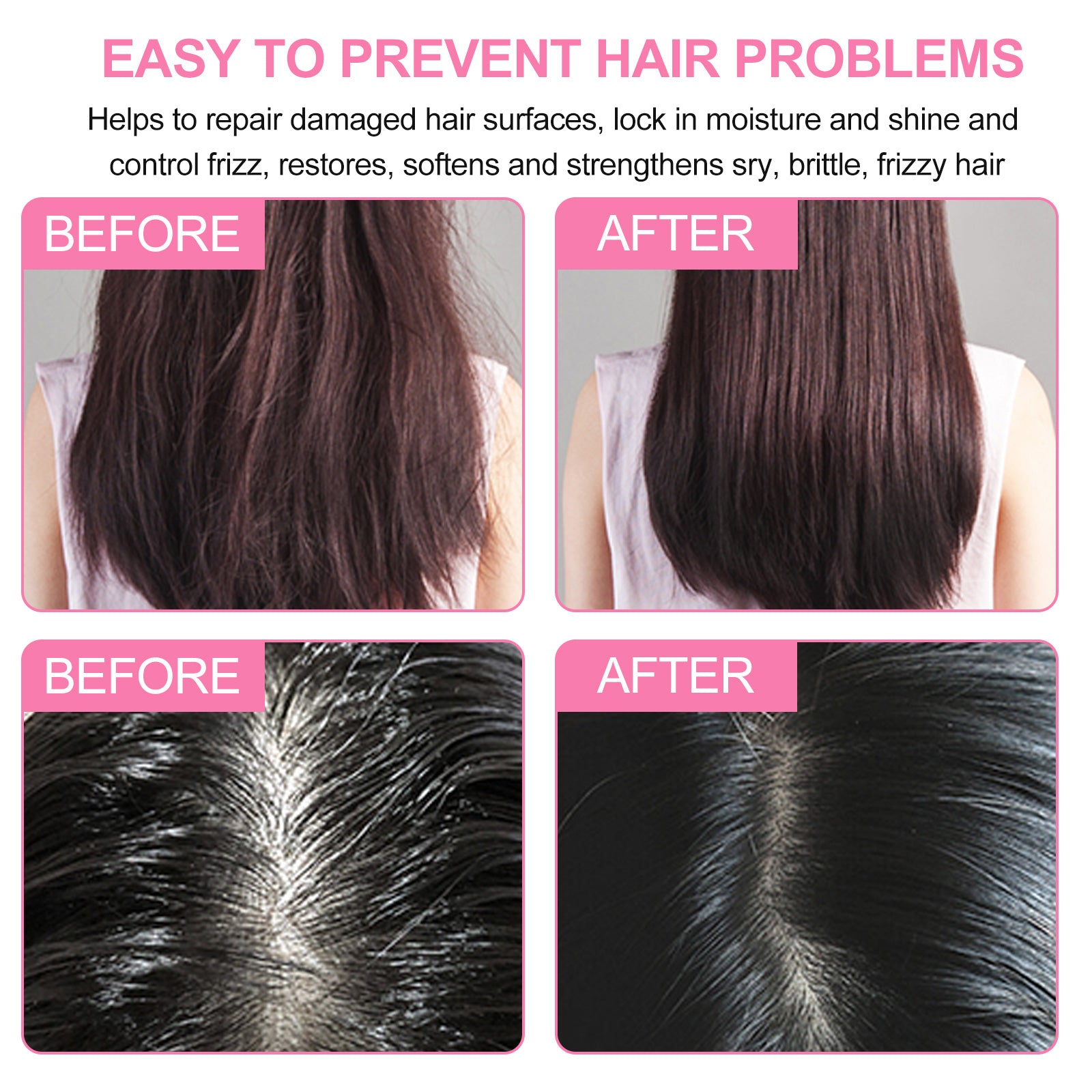 ALIVER Organic Rose Hair Growth Shampoo Bar, 60g