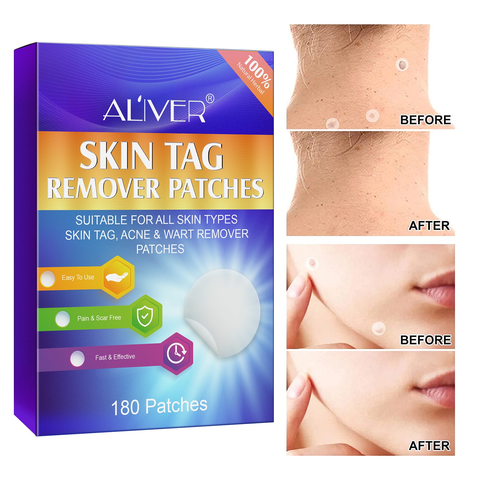 ALIVER Safe Skin Tag Remover Patches, pack of 180pcs