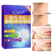 ALIVER Safe Skin Tag Remover Patches, pack of 180pcs