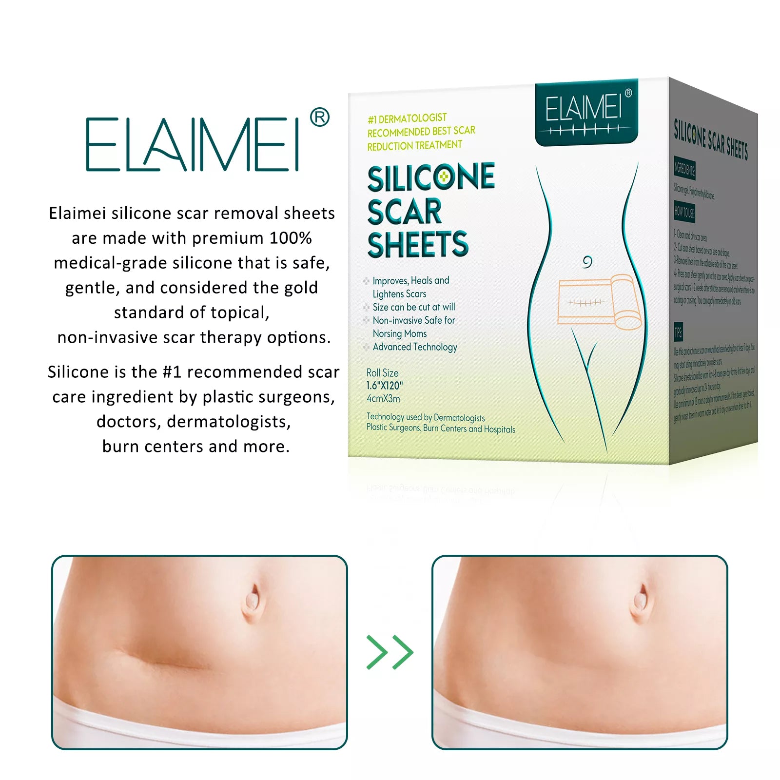 ELAIMEI Silicone Scar Removal Sheets, Roll Tape 3m