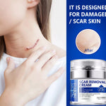 ELAIMEI Advanced Scar Removal Cream, Day & Night 50ml
