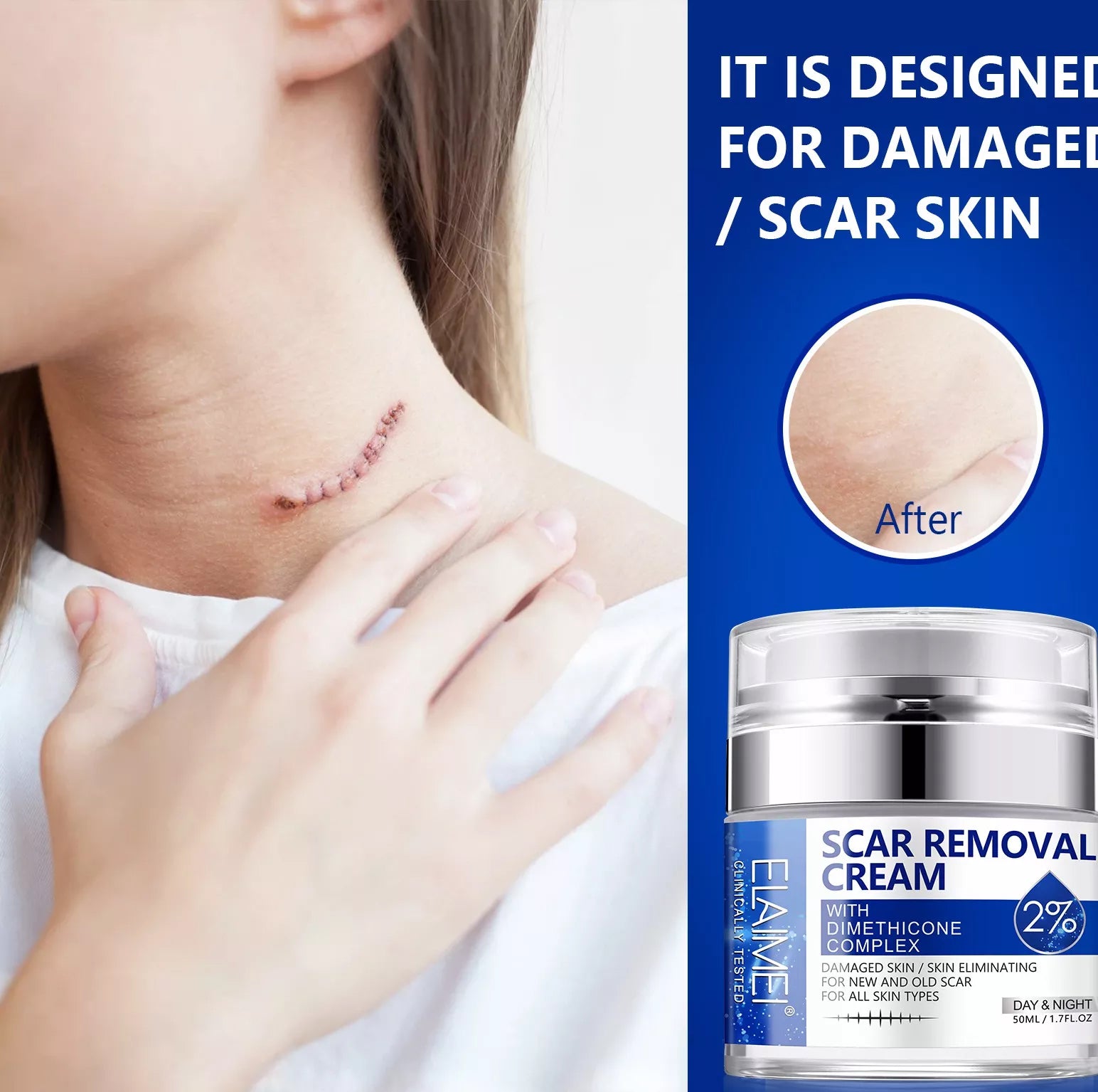 ELAIMEI Advanced Scar Removal Cream, Day & Night 50ml