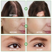 NIFEISHI 100% Pure & Natural Monarda Essential Oil, 60ml