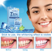 ALIVER Teeth Whitening Strips Professional Dental Oral Care