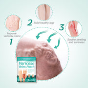 Varicose Veins Patch Treatment for Legs Relief Pain Vasculitis, Spider Vein Strengthen Capillary Health Blood Circulation Vein Care Fading  (8 count)