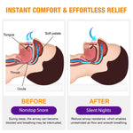 ELAIMEI Natural Anti Snoring Nasal Spray, 30ml