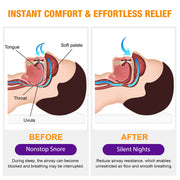 ELAIMEI Natural Anti Snoring Nasal Spray, 30ml