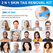 ALIVER 2in1 Blue Skin Tag Removal Kit