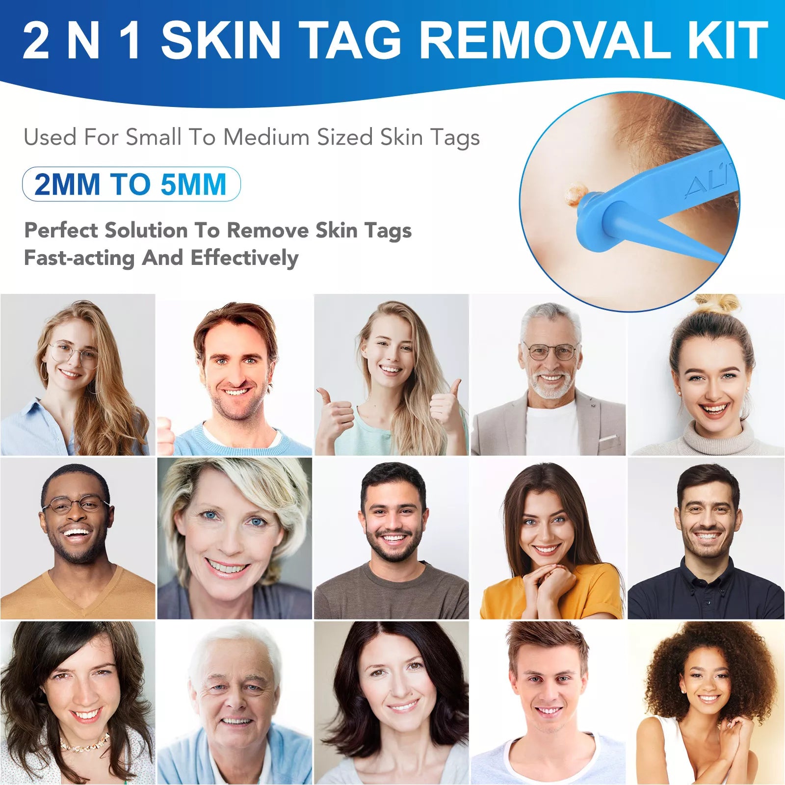 ALIVER 2in1 Blue Skin Tag Removal Kit