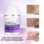 Kizenka Retinol Face Cream Moisturizer Skin Care Anti Aging Wrinkle Acne Treatment Day and Night Cream Dark Spot Remover