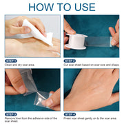 ELAIMEI Clear Silicone Scar Roll Tape, 1.5m