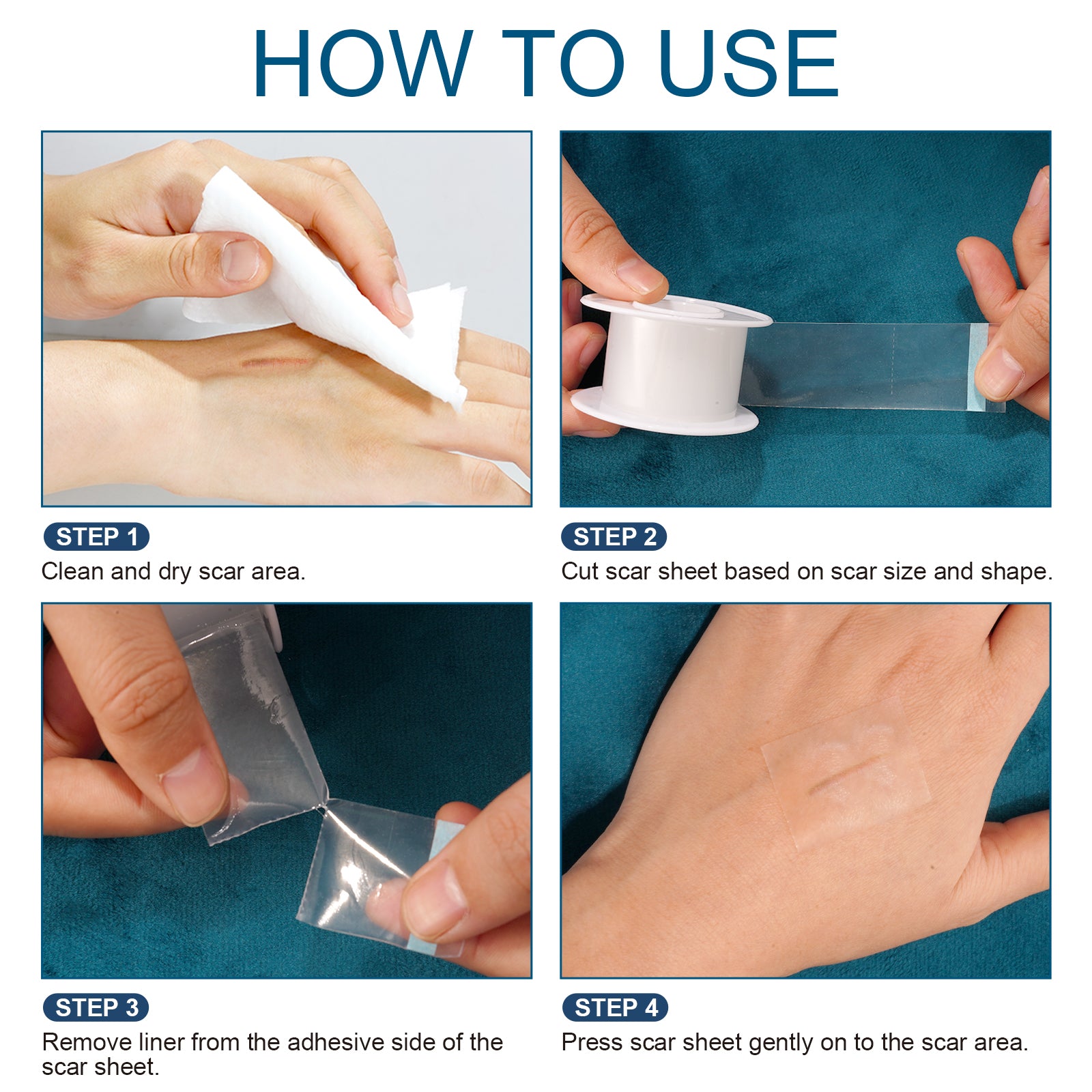 ELAIMEI Clear Silicone Scar Roll Tape, 1.5m