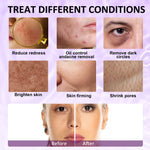 ELAIMEI Ice Roller Facial Cube Massager, Purple