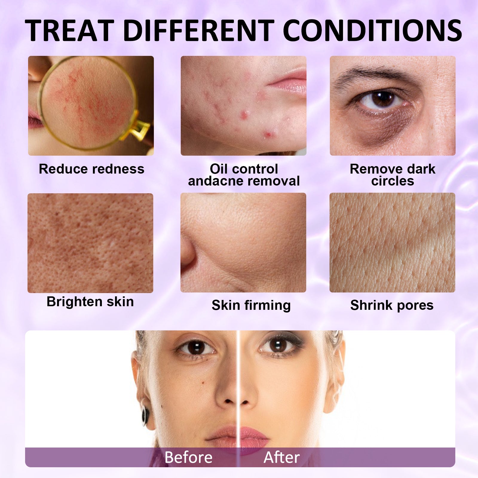 ELAIMEI Ice Roller Facial Cube Massager, Purple