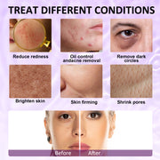 ELAIMEI Ice Roller Facial Cube Massager, Purple