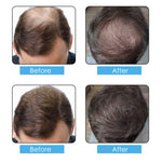 ELAIMEI Hair Loss Building Fibers, 50g (Black)