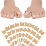 SEFUDUN Toenail Correction Stickers, pack of 100pcs
