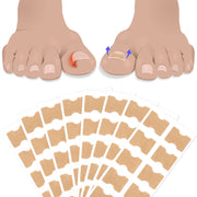 SEFUDUN Toenail Correction Stickers, pack of 100pcs