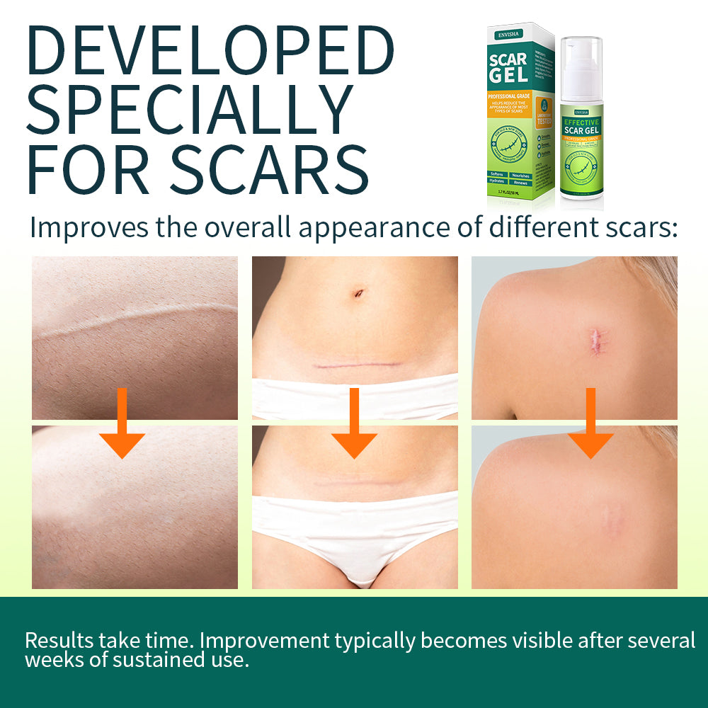 ENVISHA Scar Removal Gel, 50ml