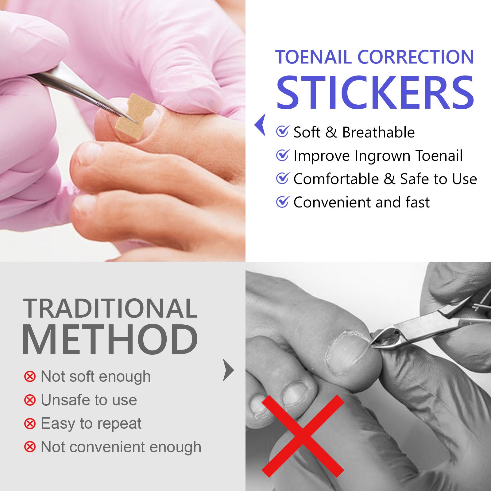 SEFUDUN Toenail Correction Stickers, pack of 100pcs
