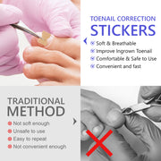 SEFUDUN Toenail Correction Stickers, pack of 100pcs