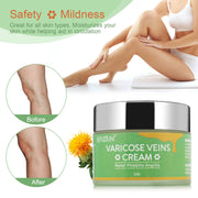 SEFUDUN Varicose Veins Cream, 50g