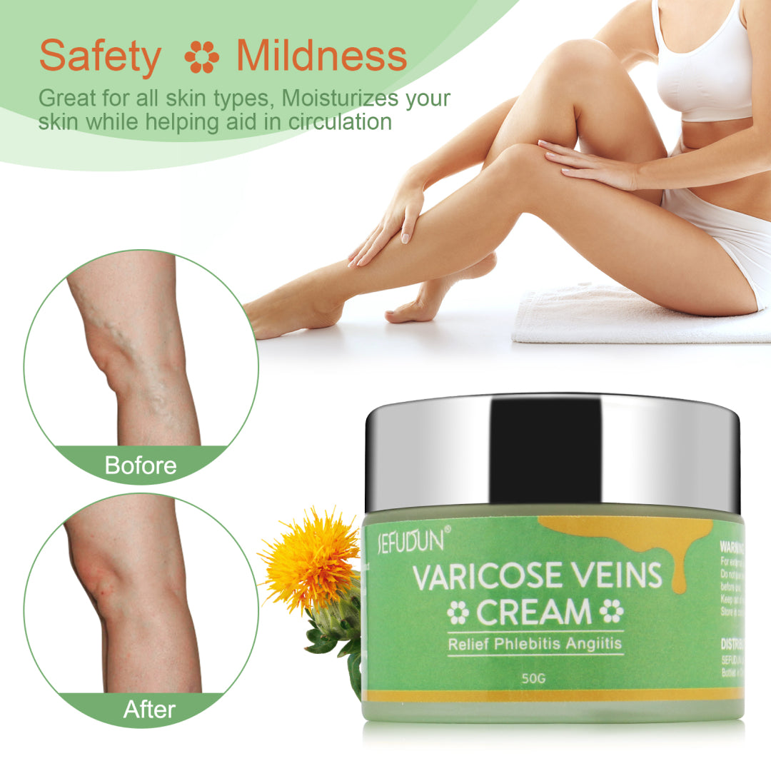 SEFUDUN Varicose Veins Cream, 50g