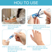 ELAIMEI Skin Tag Remover Kit, Anti Mole & Wart Body Pens, 4pcs