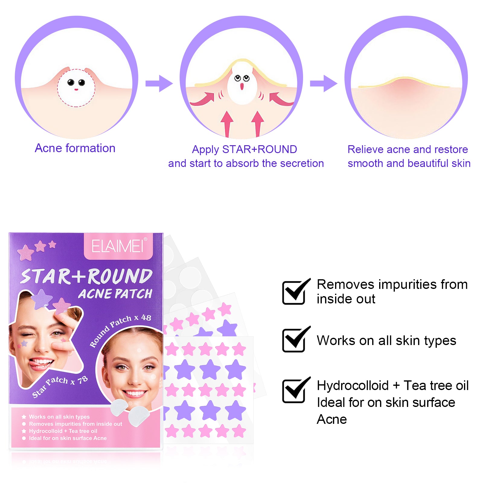 ELAIMEI Stars + Round Pimple Patches, pack of 126pcs