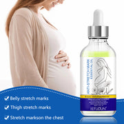SEFUDUN Anti Stretch Mark Essential Oil, 30ml