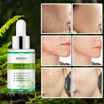 ENVISHA Dark Spot Corrector Oil, 30ml