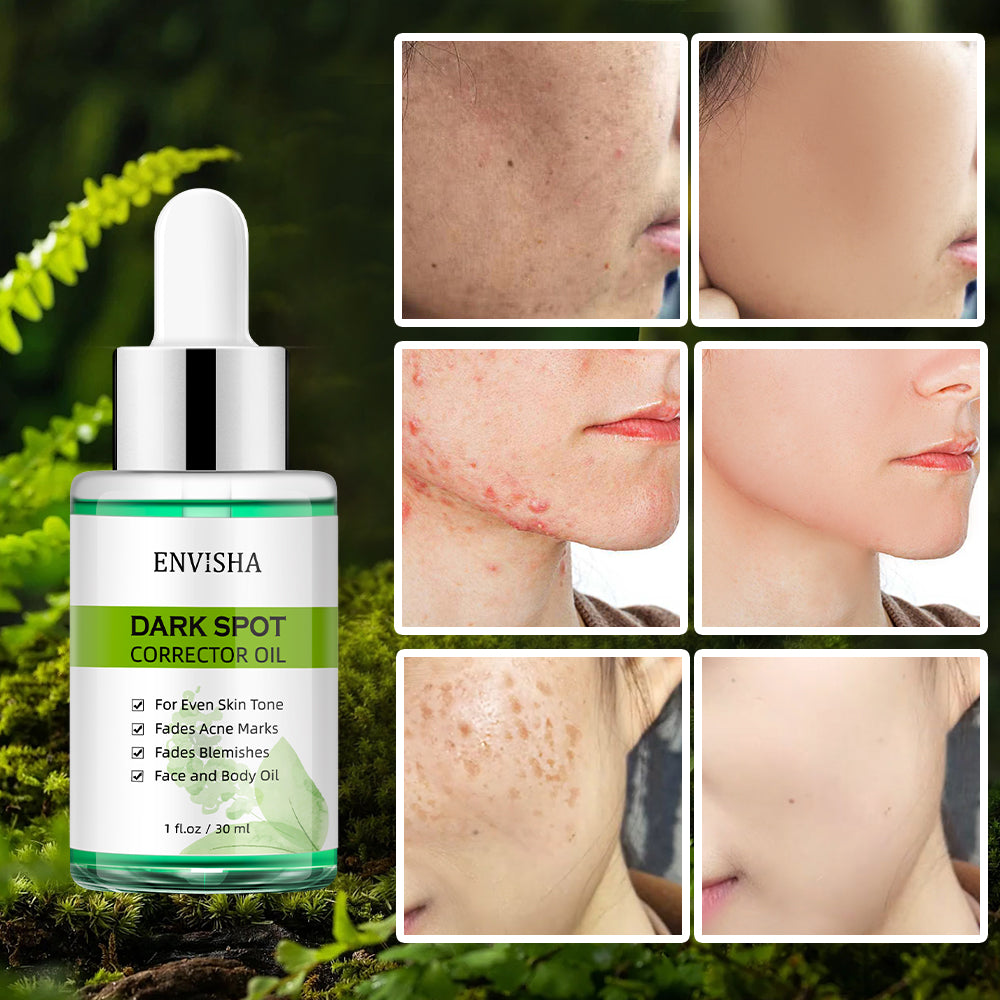 ENVISHA Dark Spot Corrector Oil, 30ml
