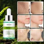 ENVISHA Dark Spot Corrector Oil, 30ml