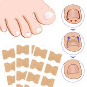 SEFUDUN Toenail Correction Stickers, pack of 100pcs