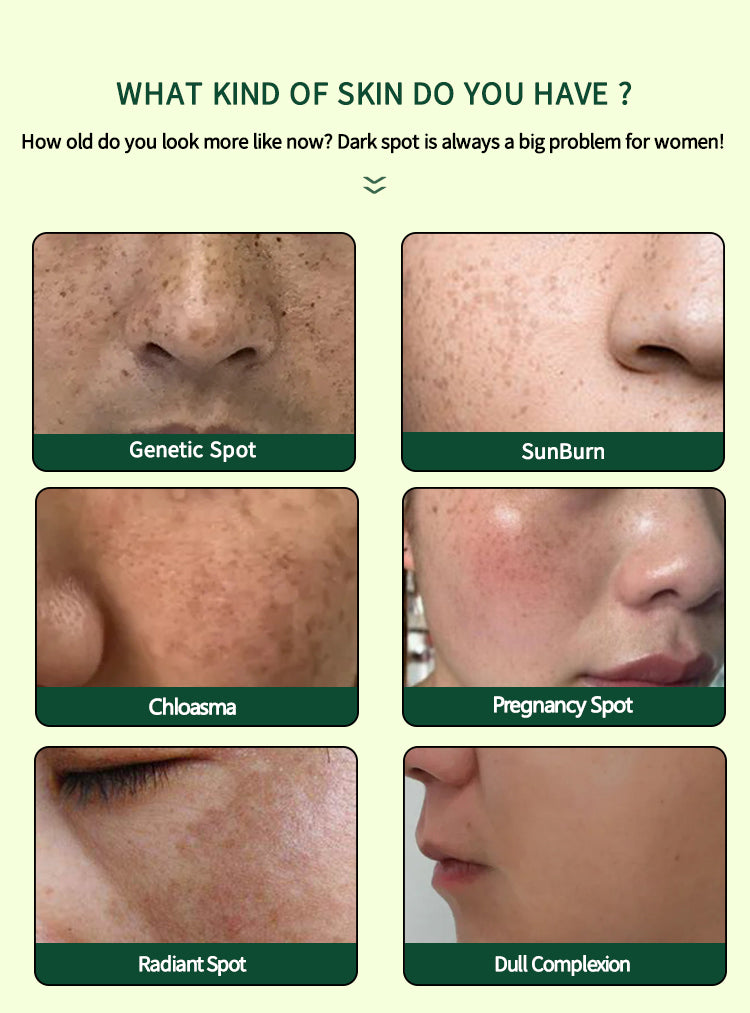 ENVISHA Dark Spot Corrector Cream, 50ml