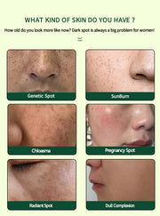 ENVISHA Dark Spot Corrector Cream, 50ml