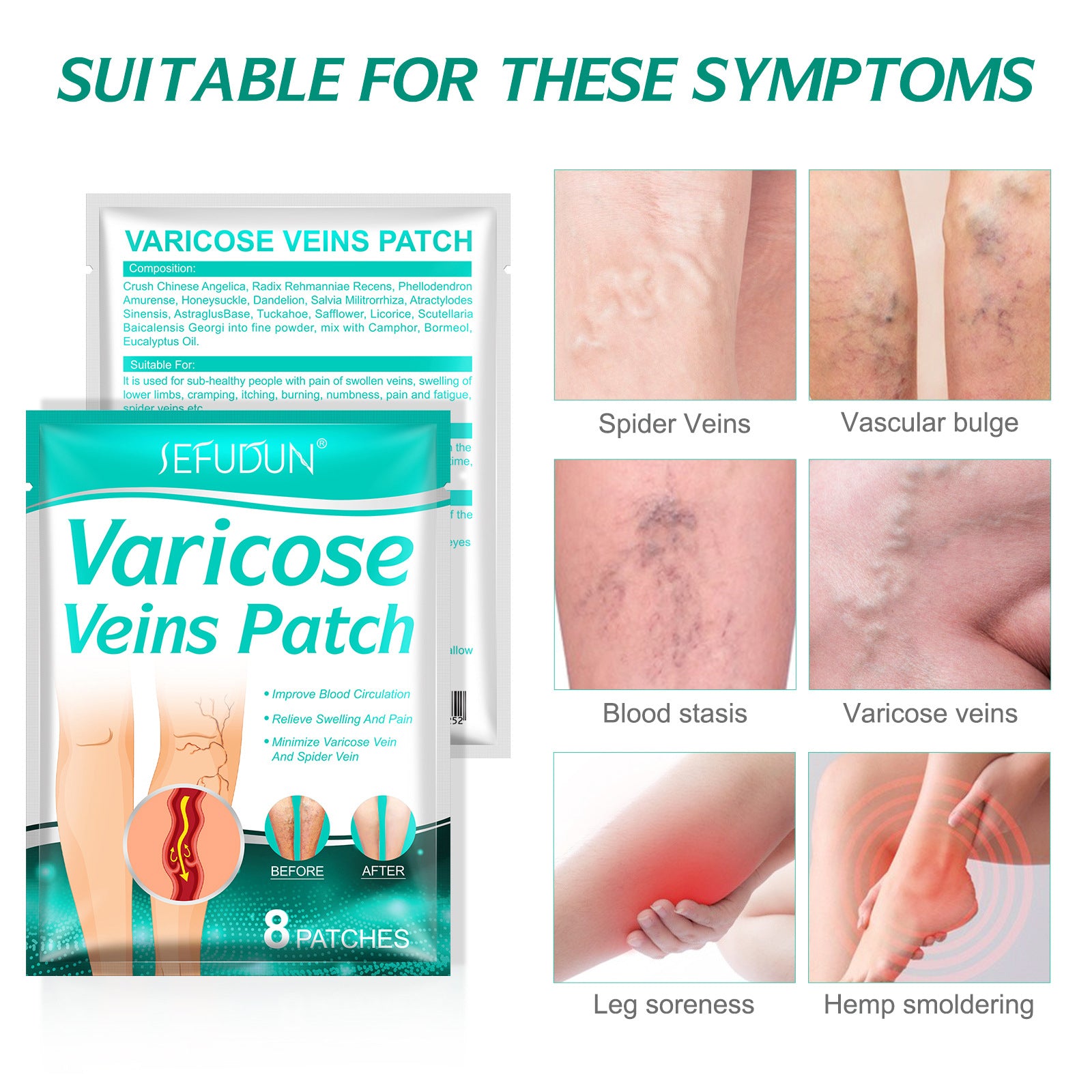 Varicose Veins Patch Treatment for Legs Relief Pain Vasculitis, Spider Vein Strengthen Capillary Health Blood Circulation Vein Care Fading  (8 count)