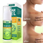 ENVISHA Scar Removal Gel, 50ml