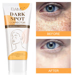 ELAIMEI Dark Spot Corrector, Whitening Skin Cream 60ml