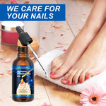 SEFUDUN Removal Paronychia Oil, 30ml