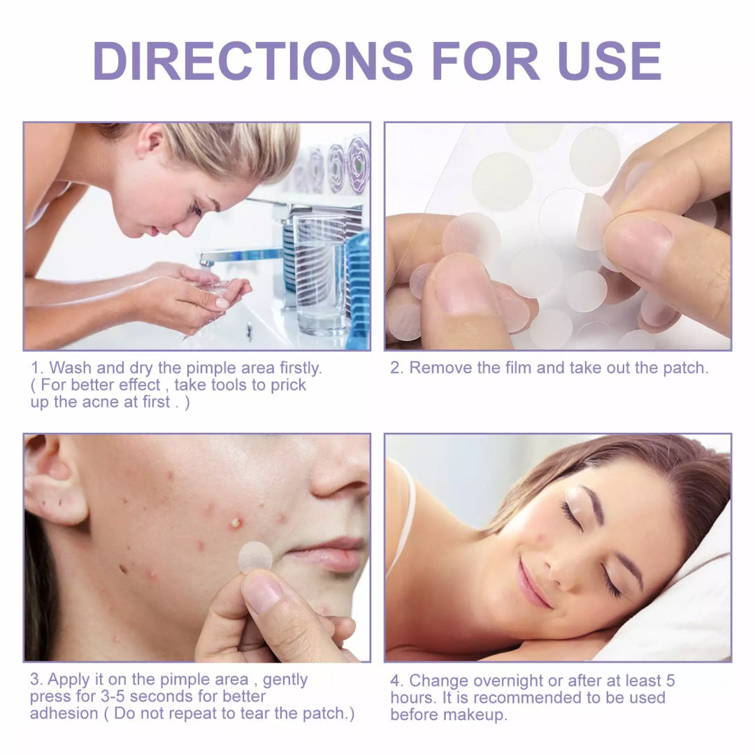 Elaimei Removal Acne Pimple Patches Plasters Face Skin Dot Stickers Cover Treatment Hydrocolloid Spot Blemishes Comedone Remover Cleaner (24 pcs )