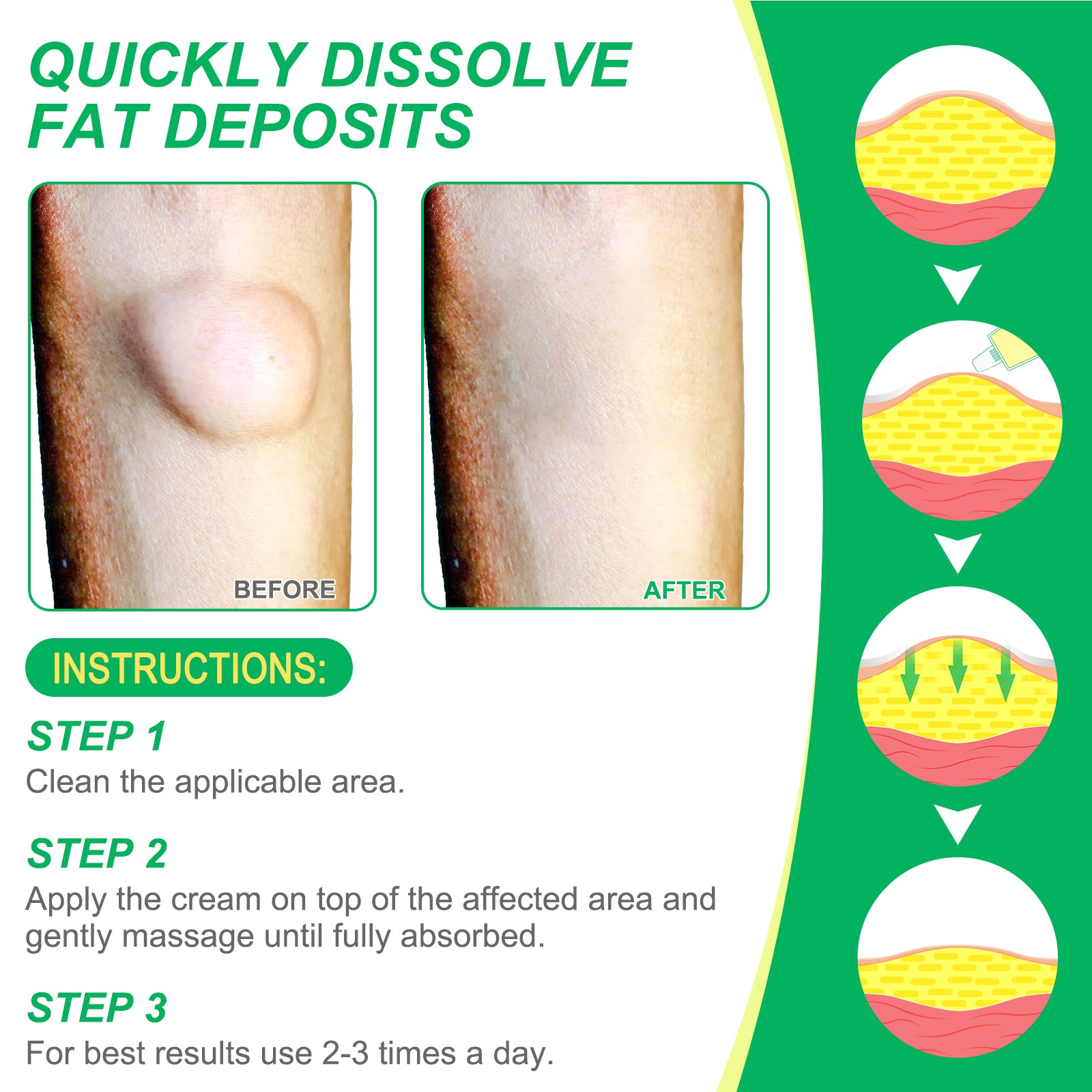 SEFUDUN Lipoma Removal Cream, 20g