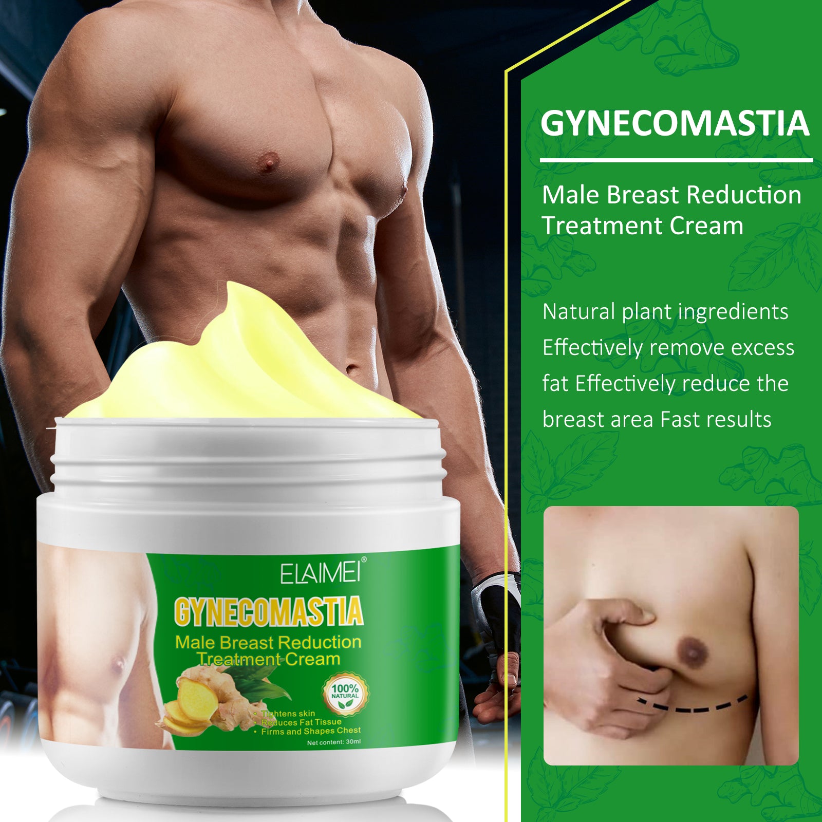 ELAIMEI Gynecomastia Male Breast Treatment Cream, 30ml